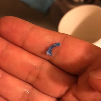 Hipp Tahıllı Mamadan Çıkan Plastik Parçası