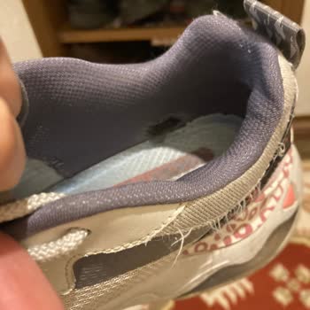 Skechers Hatalı Ürüne Kullanıcı Hatası Deniyor