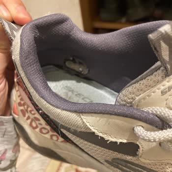 Skechers Hatalı Ürüne Kullanıcı Hatası Deniyor
