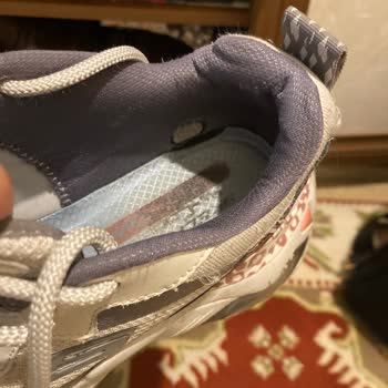 Skechers Hatalı Ürüne Kullanıcı Hatası Deniyor