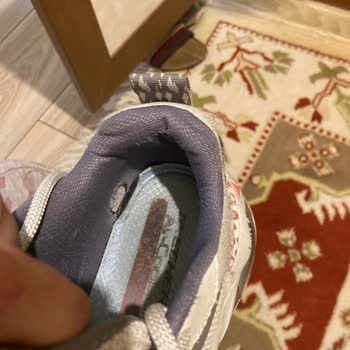 Skechers Hatalı Ürüne Kullanıcı Hatası Deniyor
