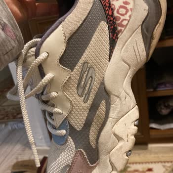 Skechers Hatalı Ürüne Kullanıcı Hatası Deniyor