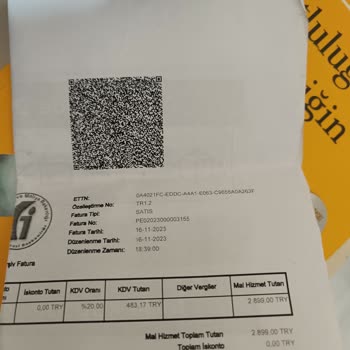 Teknosa Dan Philips Ütü Aldım Sorunlu Çıktı Değişimde