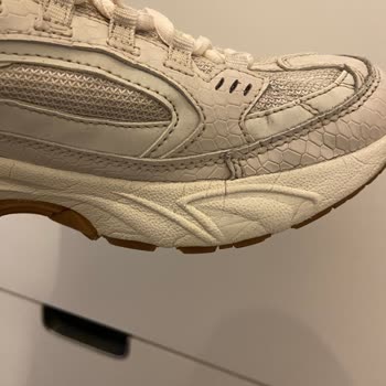Skechers'ın Sorunlu Ayakkabısı