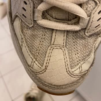 Skechers'ın Sorunlu Ayakkabısı