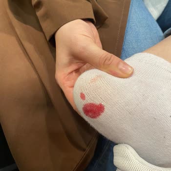 FLO Ayakkabı Alarm İğnesi Kazası Ve İlgisiz Personel