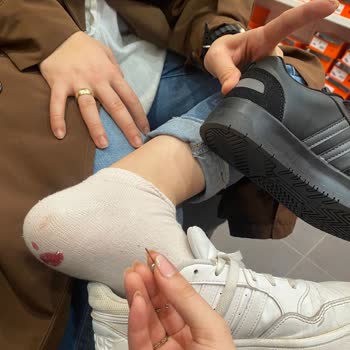 Symbol Avm Kocaeli Symbol AVM'de Alarm İğnesiyle Yaralanan Müşteri Deneyimi