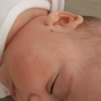 İstanbul Alerji Merkezi Tedavi Süreci!