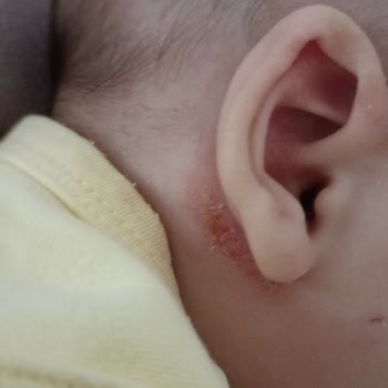 İstanbul Alerji Merkezi Tedavi Süreci!