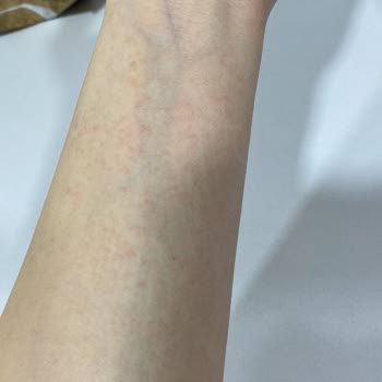 Mustela Çatlak Kremi - Kaşıntı