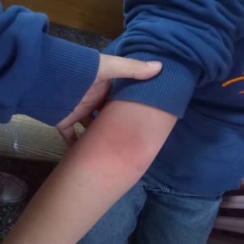 Ali Şefik Ortaokulu Kızıma Fiziksel Ve Sözlü Şiddet