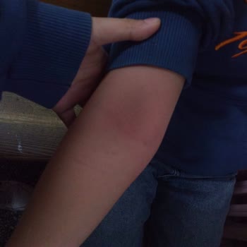 Ali Şefik Ortaokulu Kızıma Fiziksel Ve Sözlü Şiddet