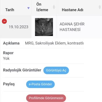 Adana Şehir Hastanesi MR Raporumu 2 Aydır Bekliyorum