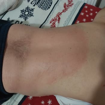 Santa Farma Thermoflex Krem Yan Etkisi İle Dertliyim