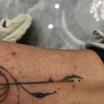 Aris Güzellik Merkezleri Aris Antalya Vip Epilasyon Sırasında Dövmem Patlatıldı.