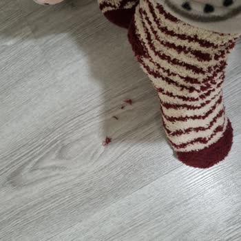 Penti Soket Çorap Tüyleri Dökülüyor