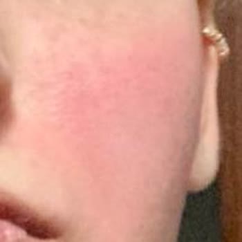 Watsons Frudia Marka Ürünler Cildimi Mahvetti