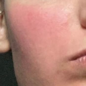 Watsons Frudia Marka Ürünler Cildimi Mahvetti