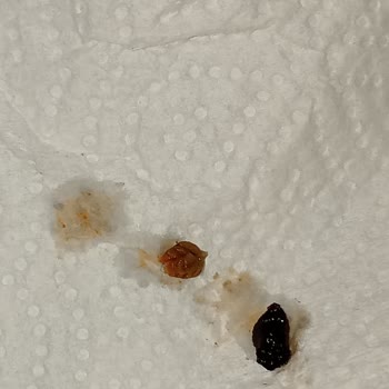 Oba Makarna Noodle İçinden Kurt Çıktı