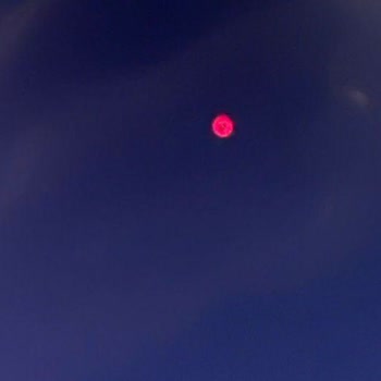 Philips TV'de Piksel Sorunu