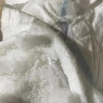 Molfix Tuz Çıktı Bezden