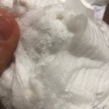 Molfix Tuz Çıktı Bezden