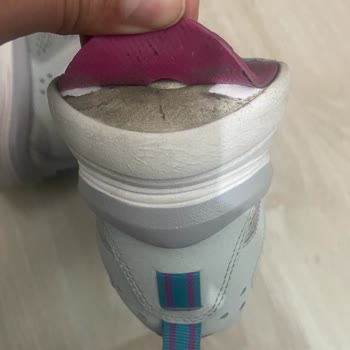 Skechers Ayakkabı Açılma Hatası