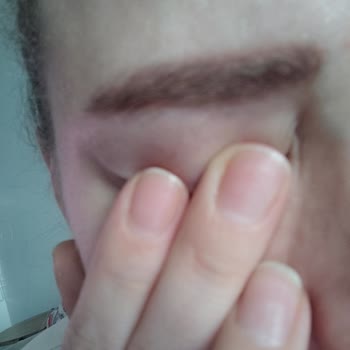 Burcu Beauty Center Güzellik Merkezi Deneyimim Ve Beklentilerim