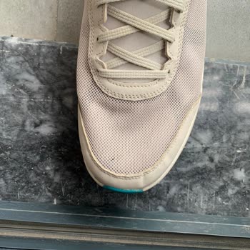 Skechers'ın 6 Ayda Yırtılan Ayakkabısı.