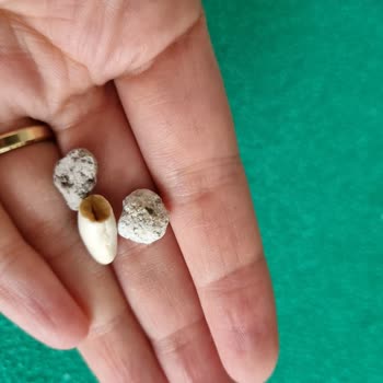 Reis Gıda Reis Marka Kuru Fasulyede Bir Sürü Taş