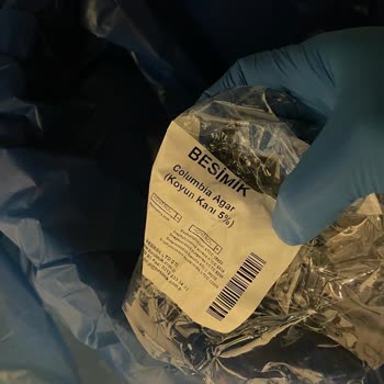 Tıp Kim San Ve Besimik Kontamine Ağar Gönderme Konusunda Çok Uzmanlar