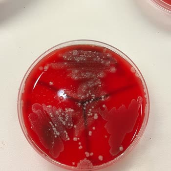 Tıp Kim San Ve Besimik Kontamine Ağar Gönderme Konusunda Çok Uzmanlar