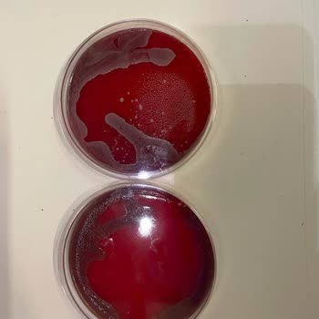 Tıp Kim San Ve Besimik Kontamine Ağar Gönderme Konusunda Çok Uzmanlar