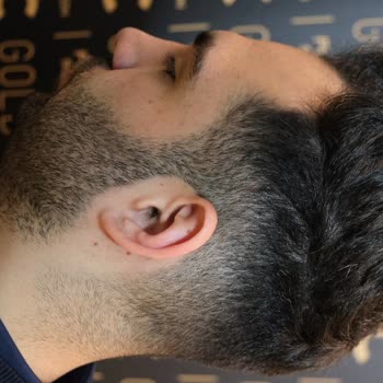 Gold City Hair İstanbul 11 Ayın Sonundaki Pişmanlık