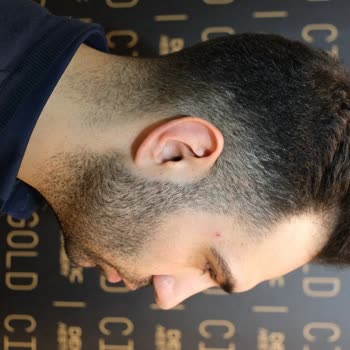 Gold City Hair İstanbul 11 Ayın Sonundaki Pişmanlık