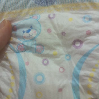 Molfix Bez Çok Kötü