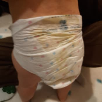 Minies Bez Transparan Minies Bezleri;) )