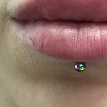 Estetik Land Dudak Dolgusu Zaman İçinde Top Şeklinde Belirtiler Veriyor!