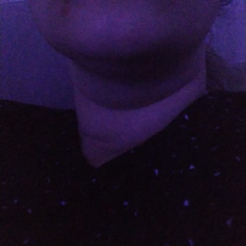 Nivea Nemlendirici Mavi Kutu Yüzümü Yaktı