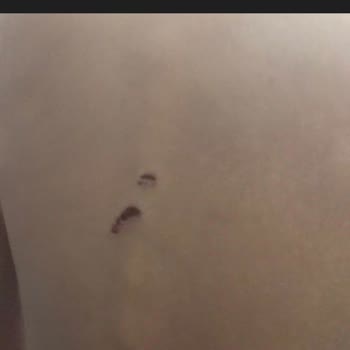 Özel Gülveren Anaokulu Çocuğum Darp Edildi