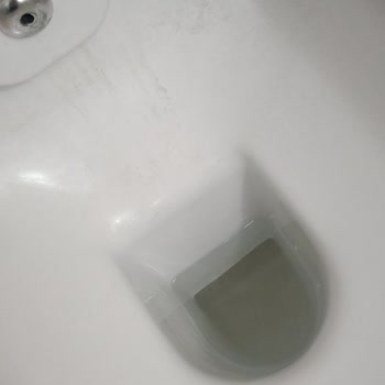 Kale Klozetteki İnatçı Lekeler Ve Servis Sorunu