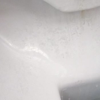 Kale Klozetteki İnatçı Lekeler Ve Servis Sorunu