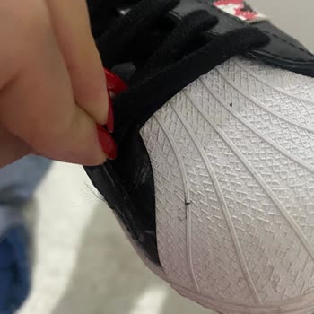 adidas 3 Giymeye Ayakkabı Yırtıldı