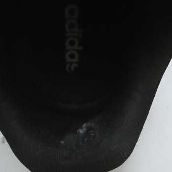 Adidas Ayakkabının Çabuk Deforme Olması Ve Firmanın Kabul Etmemesi