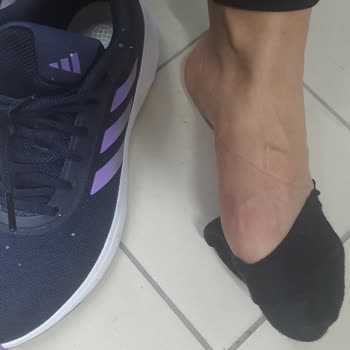 adidas Ayakkabı Kalıp Sorunu