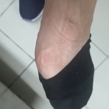 adidas Ayakkabı Kalıp Sorunu