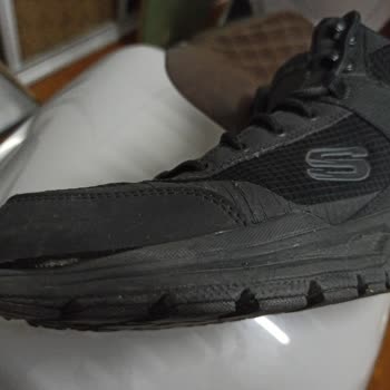Skechers İmalat Hatasını Kullanıcıya Yıktılar