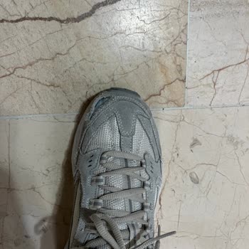 Skechers Ayakkabı Birkaç Ay İçinde Yırtıldı