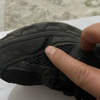 Skechers Tüketici Hatası Hakkında.