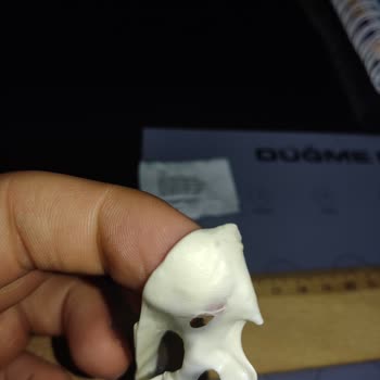 Falım Sakız İçerisinden Cam Ya Da Plastik Madde Çıktı